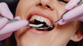 Infeksi Gusi Bisa Jadi Penyebab Penyakit Jantung. (Pexels.com/
Karolina Grabowska)
