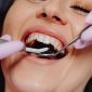 Infeksi Gusi Bisa Jadi Penyebab Penyakit Jantung. (Pexels.com/
Karolina Grabowska)
